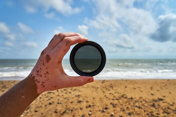 A selective of a neutral density filter in a hand of a p vitiligo