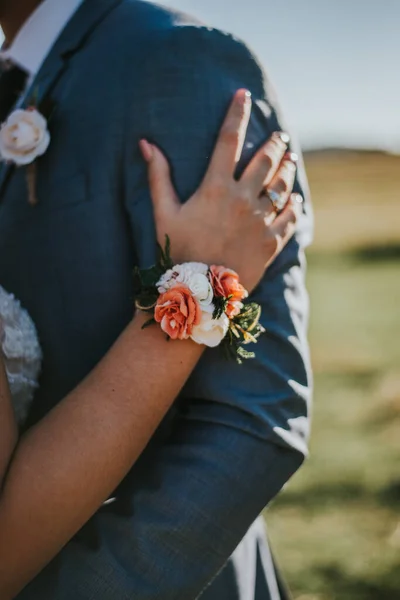 Χέρι Της Νύφης Ένα Βραχιόλι Στον Ώμο Του Γαμπρού — Φωτογραφία Αρχείου