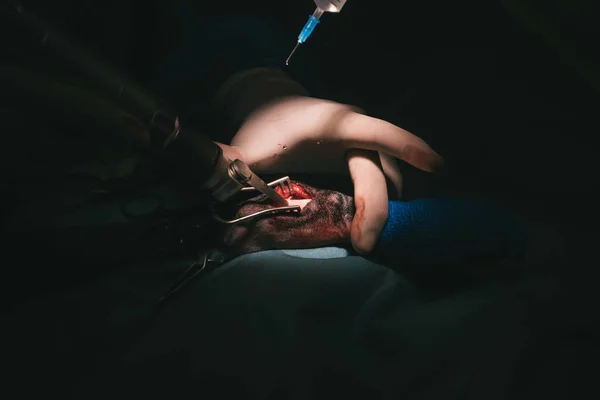 Man Performing Medical Surgery — Stock Photo, Image