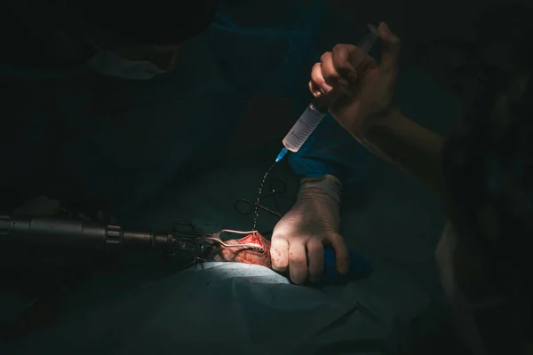 Homem Que Faz Uma Cirurgia Médica — Fotografia de Stock