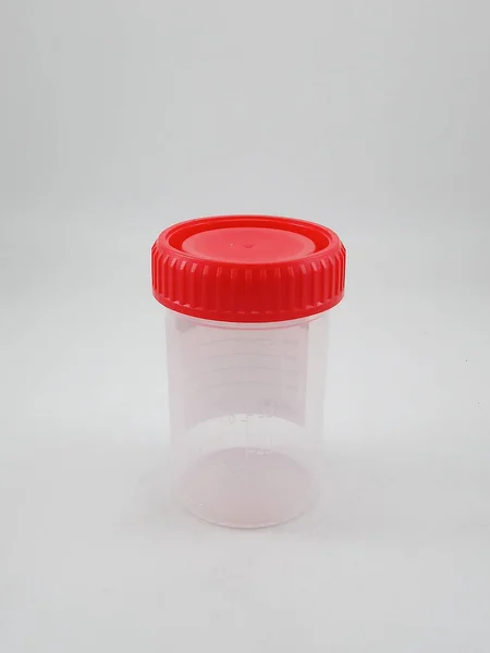 Plástico Transparente Com Tampa Recipiente Amostra Urina — Fotografia de Stock