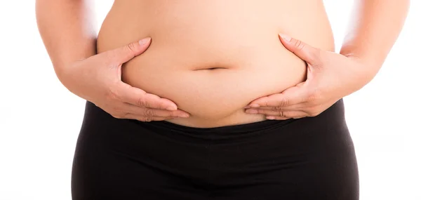 Donne con pancia grassa su sfondo bianco — Foto Stock