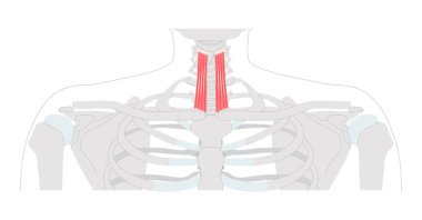 Sternothyroid - Infrahyoid muscle depicted in anatomy chart that depresses the thyroid cartilage, important for larynx movement and voice modulation, used in clinical and educational illustration