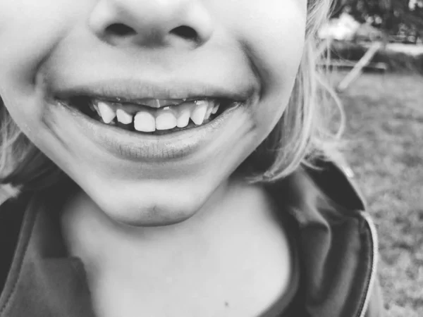 乳牙脱落 一个6岁的女孩笑了 露出了牙齿 少了几颗牙 黑白单色摄影 孩子脸上的表情或苦笑 — 图库照片