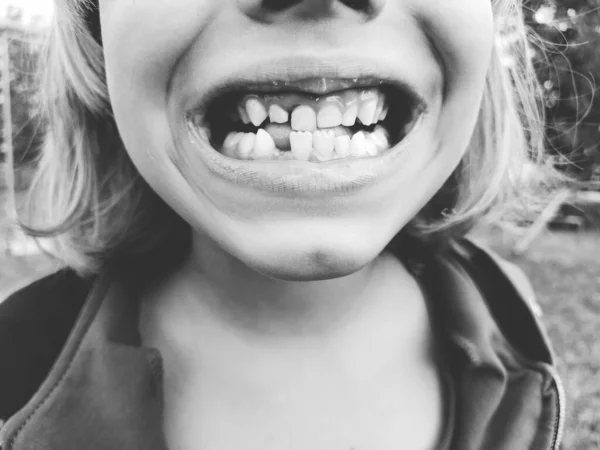 Perte Dents Lait Une Fillette Ans Sourit Montre Ses Dents — Photo