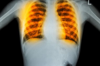 x-ray tarama insan 