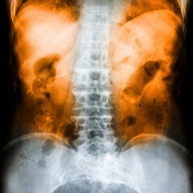 x-ray tarama insan 