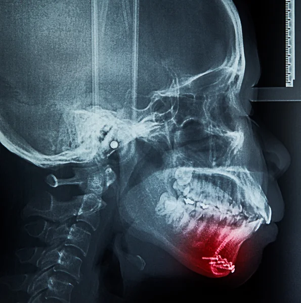 X-ray tarama insan — Stok fotoğraf