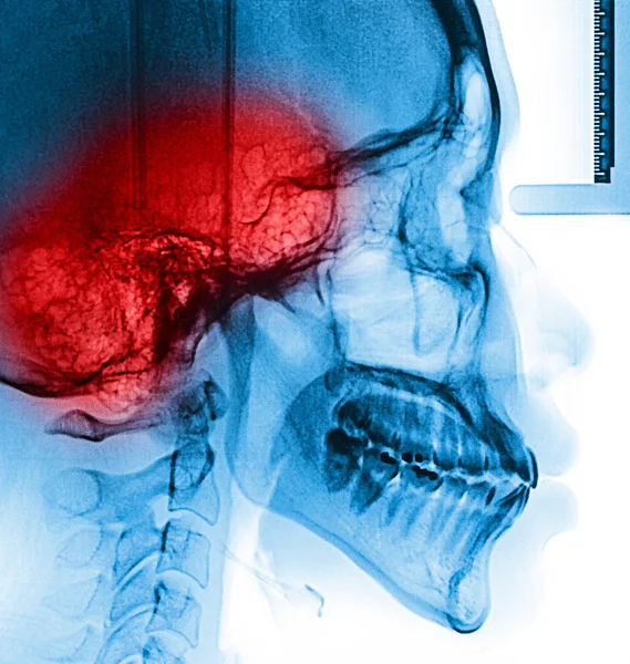 X-ray skanowania człowieka — Zdjęcie stockowe