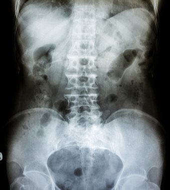 x-ray tarama insan 