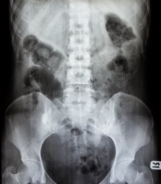 x-ray tarama insan 