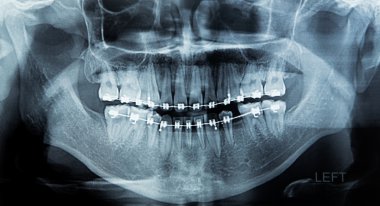 x-ray tarama insan 
