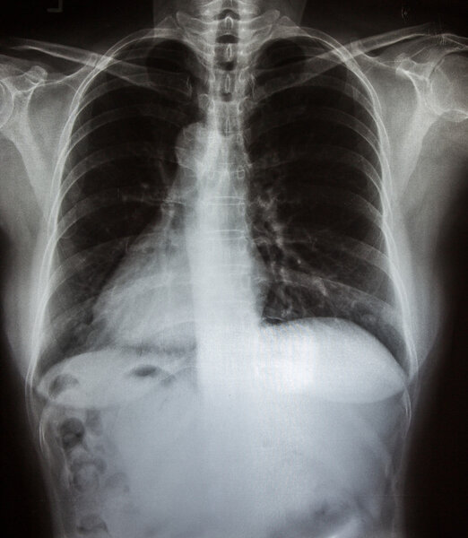 X-Ray scan human 