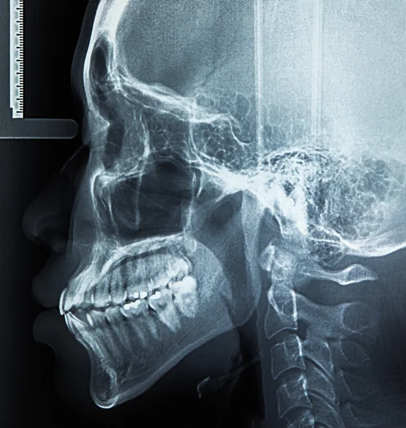 X-ray skanowania człowieka — Zdjęcie stockowe