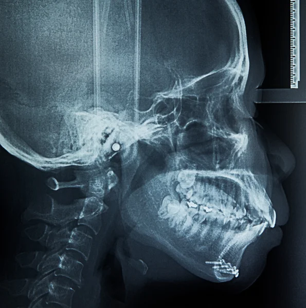 Exploración de rayos X humana — Foto de Stock
