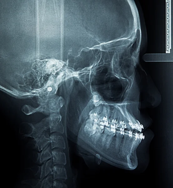 X-ray scan mens — Stockfoto