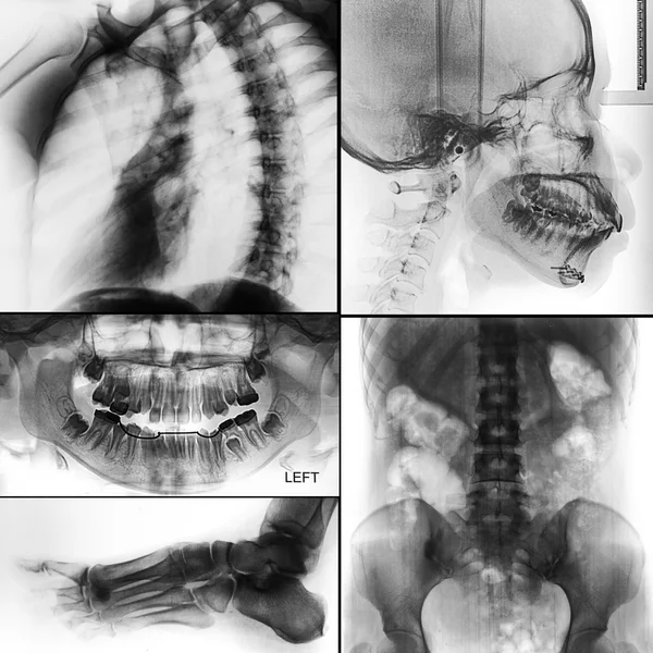 Collage de rayos X humanos foto —  Fotos de Stock