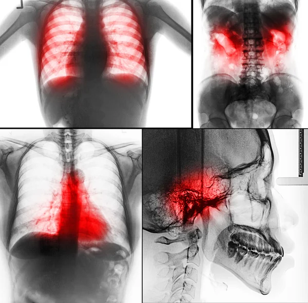 Human X-rays photos — Stock Photo, Image