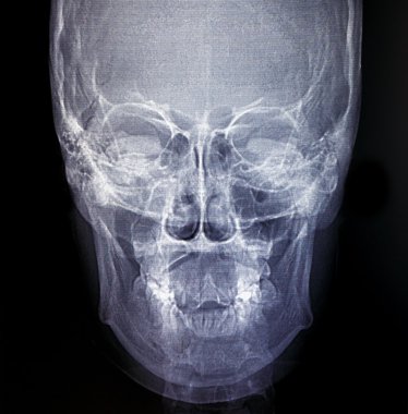 İnsan kemikleri X-Ray tarama