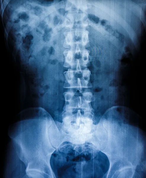 人类的骨骼 x 线扫描 — 图库照片