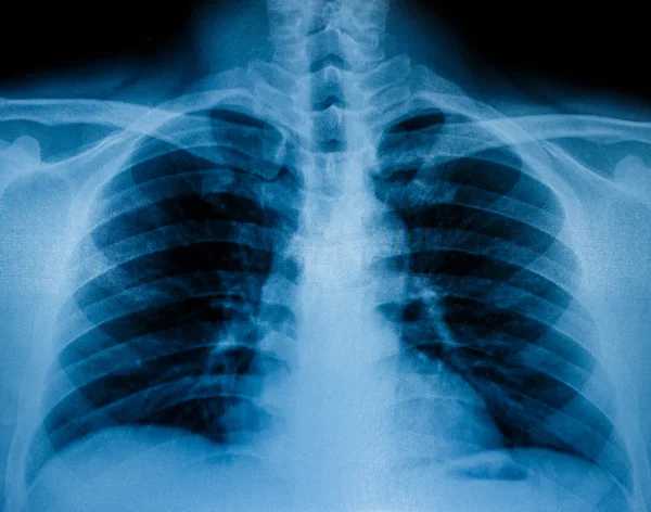 Exploración por rayos X de huesos humanos — Foto de Stock
