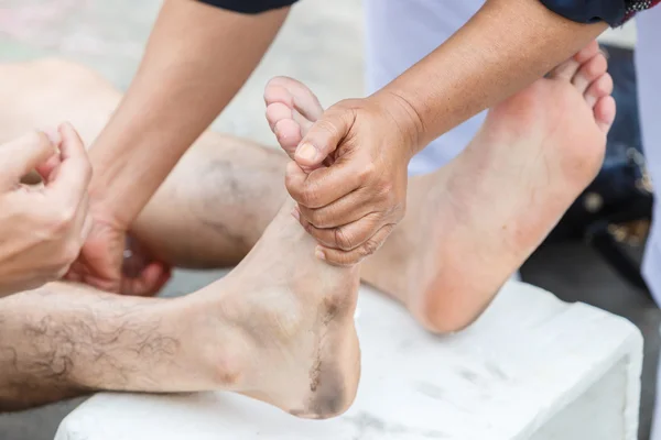 First aid for cramp injury — Stock Photo, Image