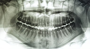 x-ray tarama insan
