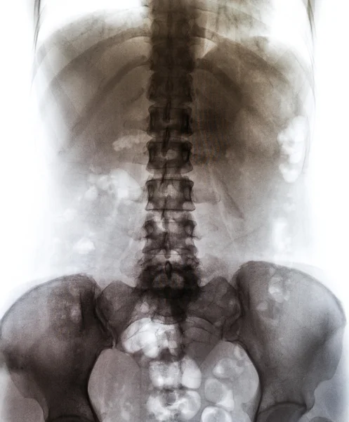 X-ray scan mens — Stockfoto