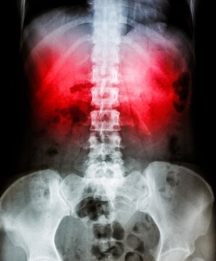 x-ray tarama insan 