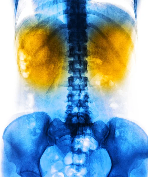 Raio-X humano scan — Fotografia de Stock