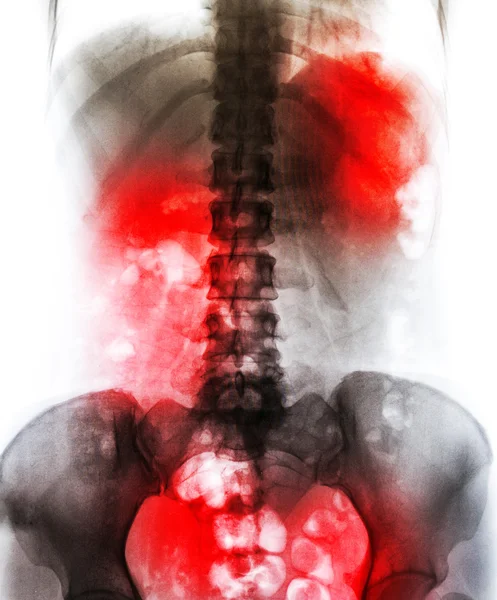 Рентгенівська сканування людини — стокове фото