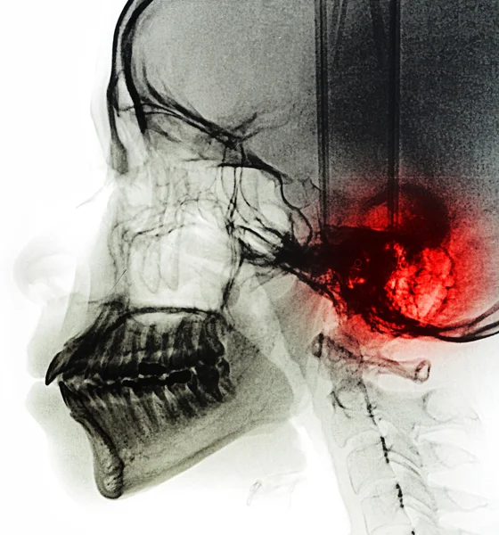 X-ray tarama dişler için insan — Stok fotoğraf