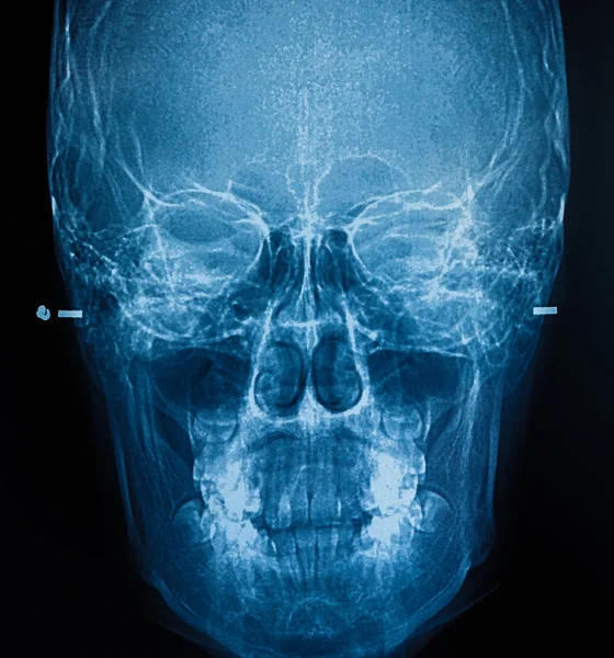 Filmu X-Ray skanowania ludzkiego — Zdjęcie stockowe