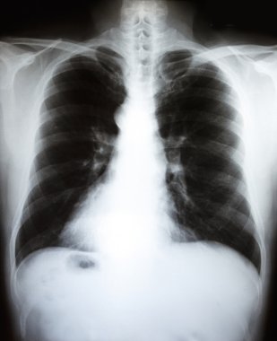 Film X-Ray tarama insan