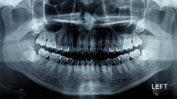Рентгеновское сканирование человека — стоковое фото