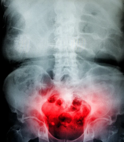 Filmu X-Ray skenování lidského — Stock fotografie