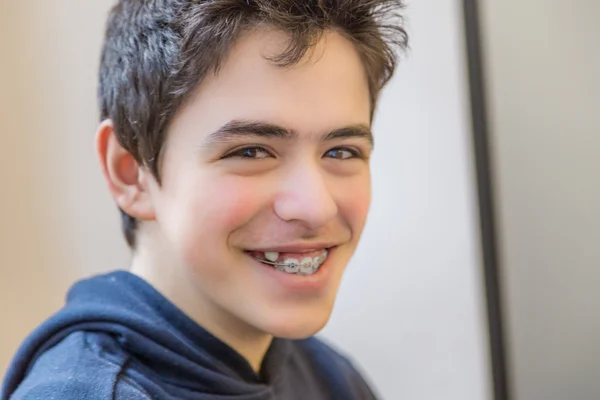 Caucasiano Menino Feliz Sorrindo Com Aparelho Nos Dentes — Fotografia de Stock
