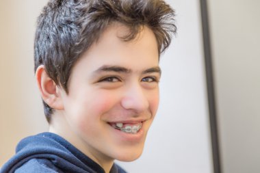 kafkas çocuk mutlu ve diş parantez ile gülümseyen