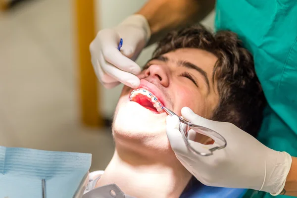 ortodontist edgewise diş cihazı parantez kontrol ederken diş hekimi sandalyede adam ve mavi ligatürler ekleme