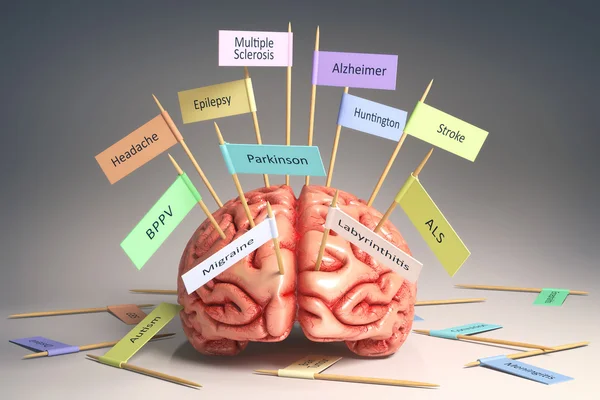 Malattie degenerative cerebrali — Foto Stock