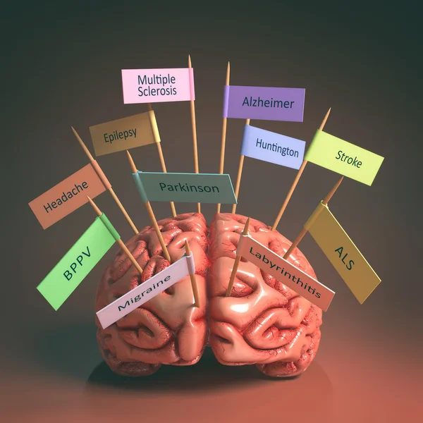 Brain Degenerative Diseases — Stock Photo, Image