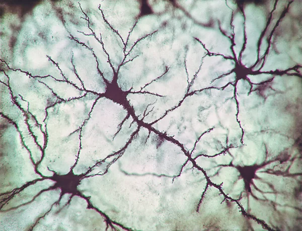 Ilustración Neuronas Sus Conexiones Simulación Microscópica Fotográfica Del Sistema Nervioso — Foto de Stock