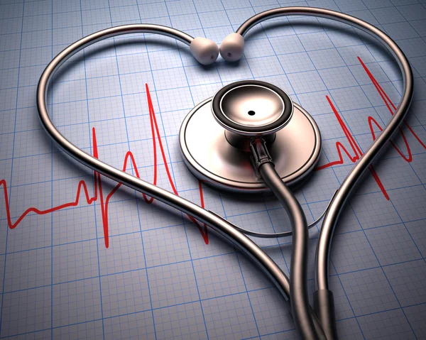 Stetoskop på grafen av patientens hjärtslag — Stockfoto