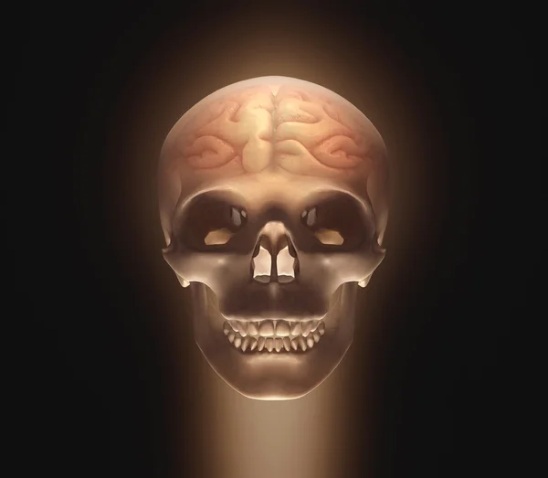 Skull with a brain inside — Stock Photo, Image