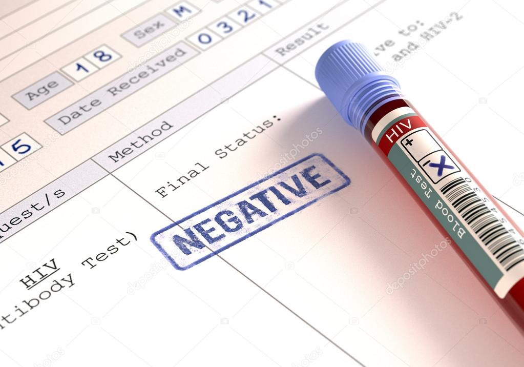western blot test for hiv western blot test for hiv