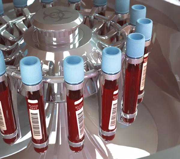 혈액 원심 분리기 기계 — 스톡 사진