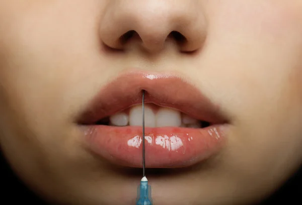 Botox-injectie — Stockfoto