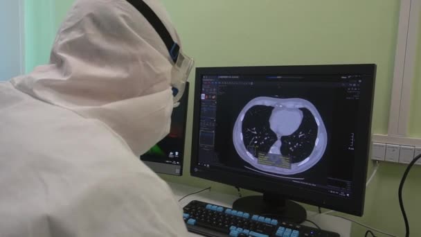 Γιατρός Εξετάζει Φθοριογραφία Της Οθόνης Των Πνευμόνων — Αρχείο Βίντεο