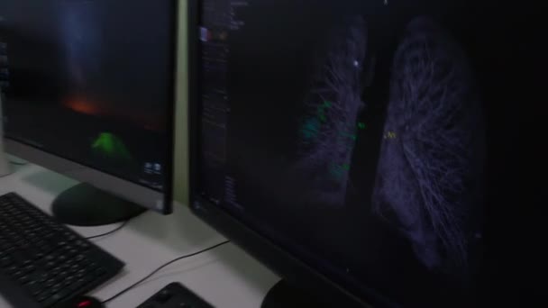 Γιατρός Εξετάζει Φθοριογραφία Της Οθόνης Των Πνευμόνων — Αρχείο Βίντεο