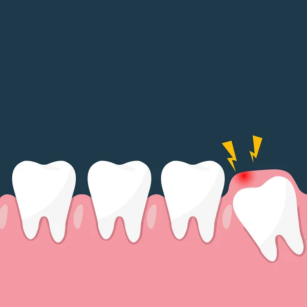 Problemi Alle Gengive Dente Del Giudizio Impattato Odontoiatria Chirurgia Dentale — Foto Stock